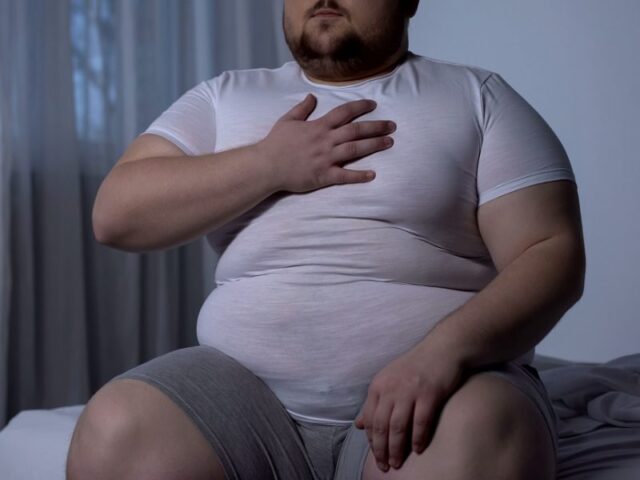 obesidad
