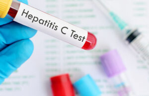 Hepatitis C: una enfermedad silenciosa que se puede curar